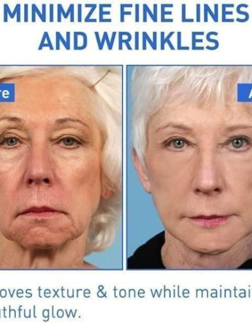 Botox Anti-Aging Serum, Youthfully Botox Face Serum (pack of 2)