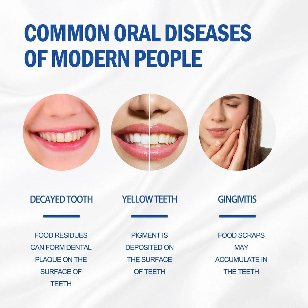 SP-4 Probiotic Whitening Toothpaste, Teeth Whitening Toothpaste (Pack of 1)